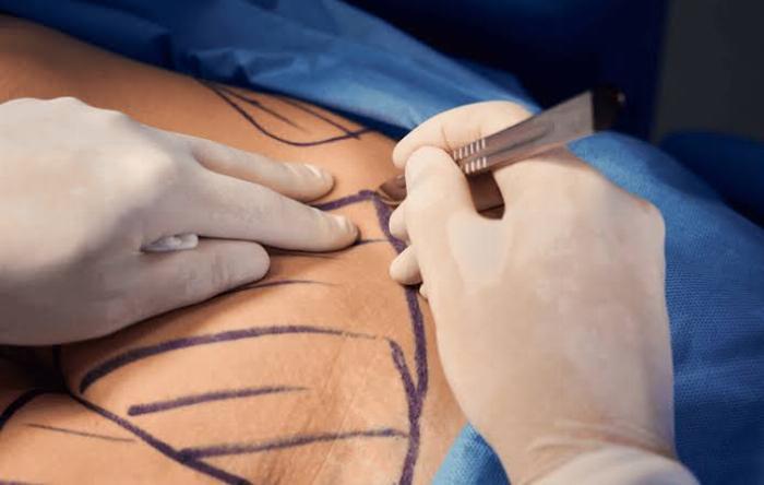 Impondrán hasta 8 años de cárcel a quien realice cirugía estética a menores sin justificación médica 